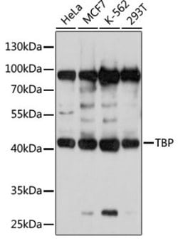 FADD Rabbit anti-Human, Mouse, Rat, Polyclonal, Novus Biologicals:Antibodies:Primary
